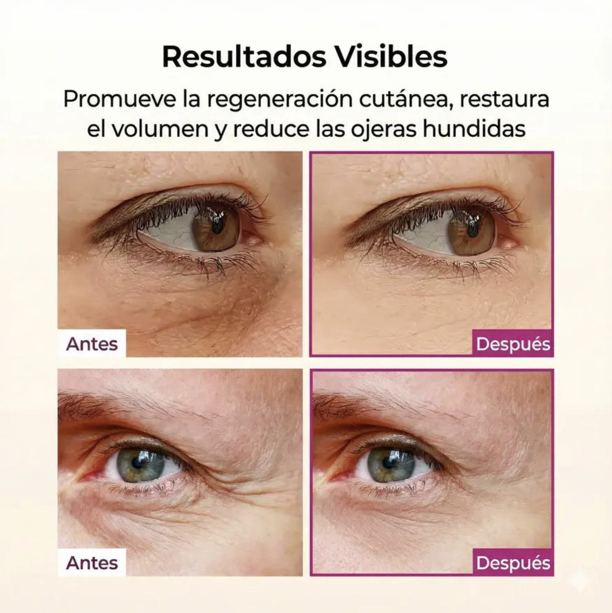 Contorno de ojos antes y después del bálsamo en barra Dr. Melaxin